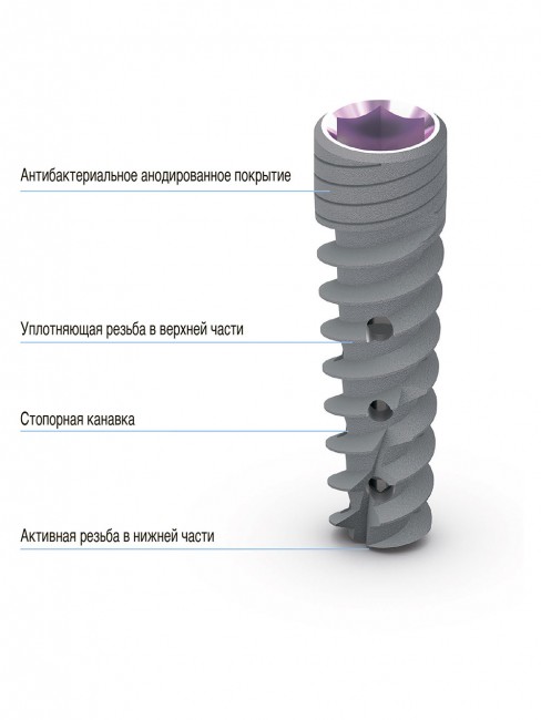 Имплантат ACTIVE (MAI)